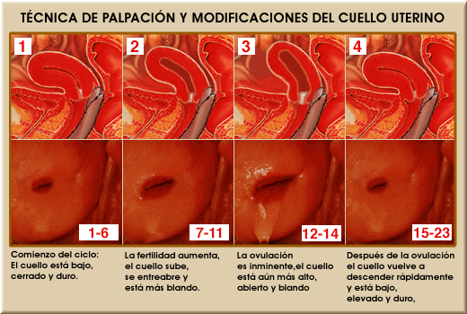 Técnica de palpación y modificaciones del cuello uterino.