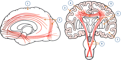 corte sagital del cerebro