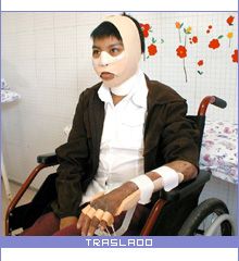 Traslado